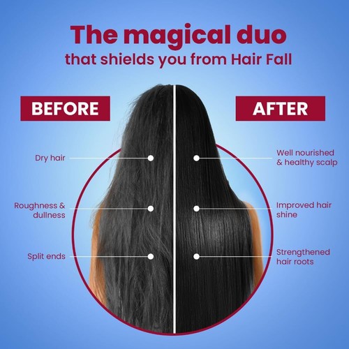 Olio per capelli alla cipolla paracadute e shampoo per capelli combo 200 ml e 275 ml - Foto 7 di 7
