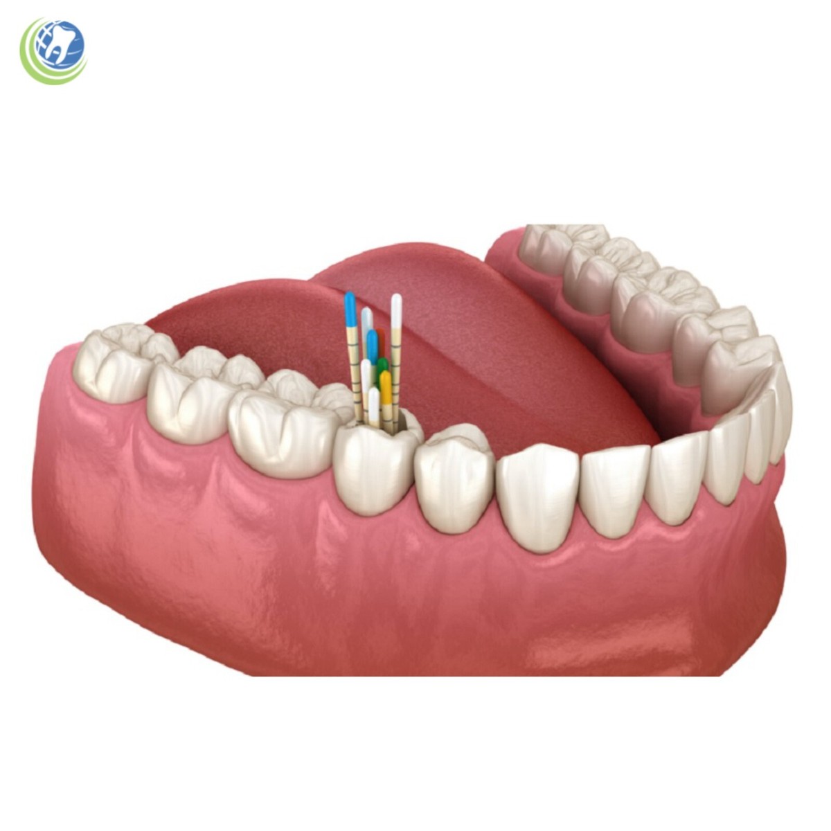 Gutta-percha Points For Endodontics - Foto 4