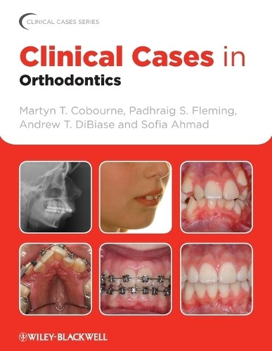 Clinical Cases in Orthodontics (Clinical Cases Uncovered) - Image 3