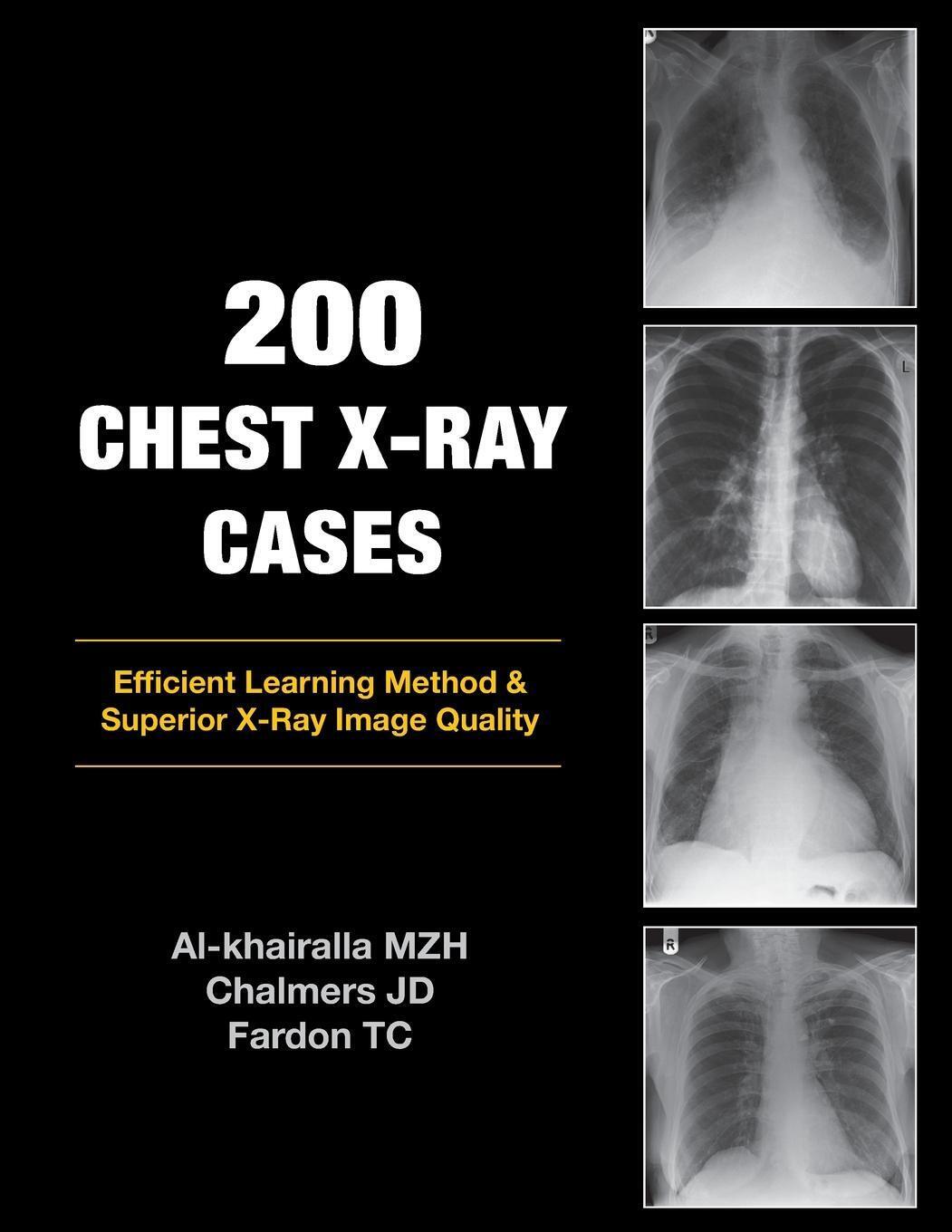 200 Chest X-ray Cases | Mudher Al-khairalla (u. A.) | Taschenbuch |