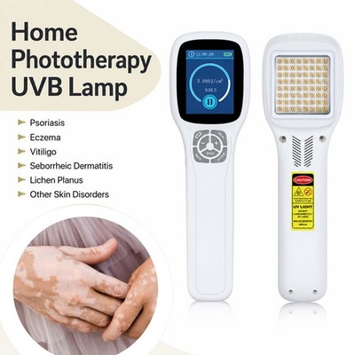 Home 308nm UVB Light Wand Shade Covers Power Supply for Daily Skin Care Kit Set