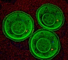 Lot of 3 Vintage Uranium Depression Glass Hazel-Atlas Florentine #1 Berry Bowls