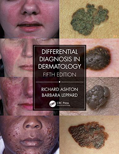 Differential Diagnosis in Dermatology, Ashton, Leppard 9780367085971 New.. - Image 3