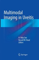 H. Nida Sen (U. A.) | Multimodal Imaging In Uveitis | Taschenbuch | Englisch