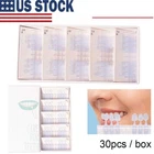30Pcs Dental Composite Porcelain Veneers Resin Light Cure Anterior Teeth Veneer