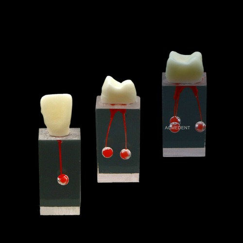 Dental RCT Files Block Endo Rotary File Practice Model Rooth Canal Pulp Crown - Picture 6 of 15