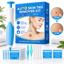 Natural Painless Auto SKIN TAG Removal Kit Skin Tag Micro Bands Remover Device