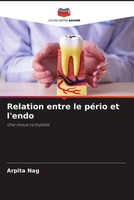 Arpita Nag | Relation Entre Le PéRio Et L'endo | Taschenbuch | FranzöSisch