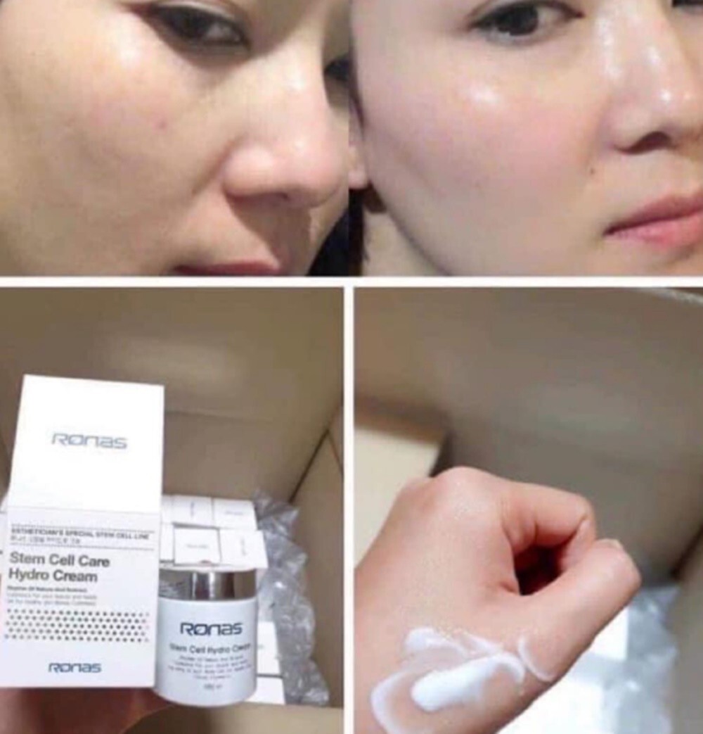 1x100ml Ronas Stem Cell Hydro Cream Moisturizing Cream Constantly