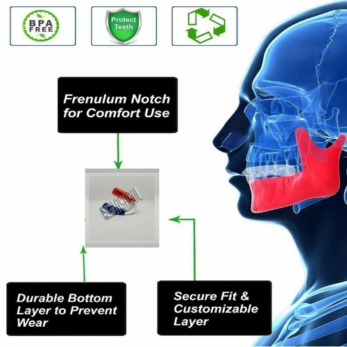 Mouth Guard Gum Shield Teeth Protector Boil Bit Football, Boxing, MMA, Rugby - Picture 3 of 8