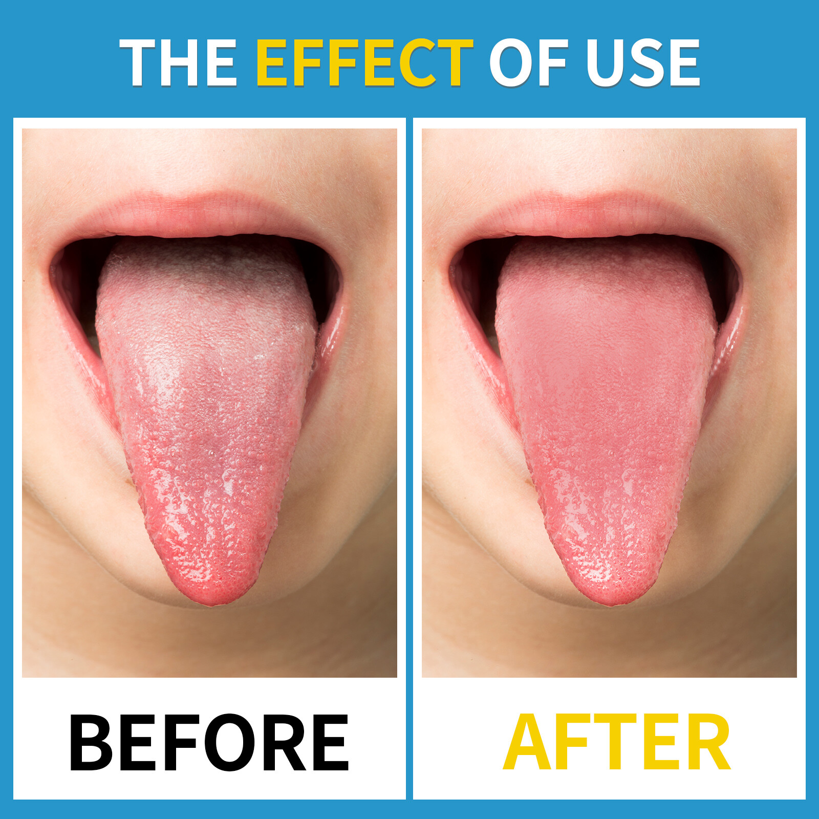 GENKENT Tongue Scraper Stainless Original color+rose gold,with portable