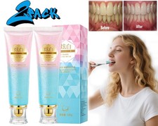 2 PCS Niacinamide Whitening Toothpaste Niacinamide Toothpaste Teeth Whitening US