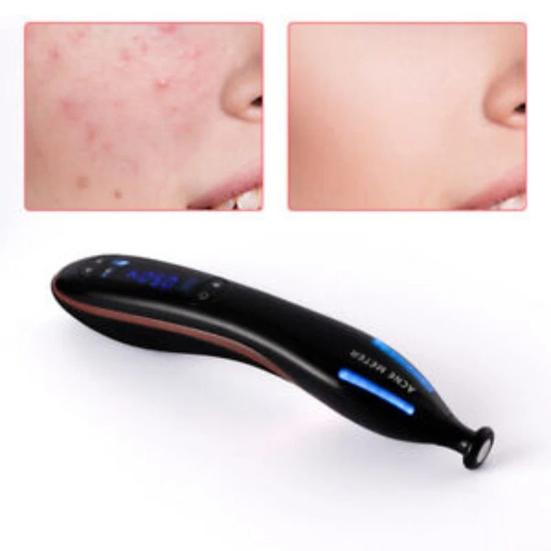 Skin Rejuvenation Treatment Acne Scar Freckle Removal Plasma Pen Beauty Machine - Imagem 2 de 4