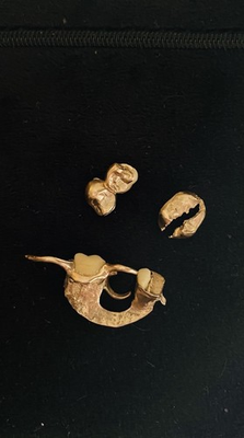 #ad Personal 16k Gold Teeth 3 Pieces Tooth Dental Work Crowns Bridges 11.66g Solid $899.00