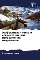 K. Nirmalakumari (U. A.) | Jeffektiwnaq Setka I Segmentaciq Dlq Izobrazhenij...