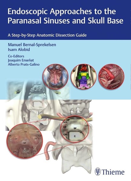 Endoscopic Approaches To The Paranasal Sinuses And Skull Base Manuel Bernal ...-image