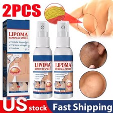 2X Lipomheilung Reduction Spray, Instant LumpFree Lipoma Removal Spray US