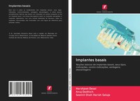 Harshjeet Desai (U. A.) | Implantes Basais | Taschenbuch | Portugiesisch (2020)