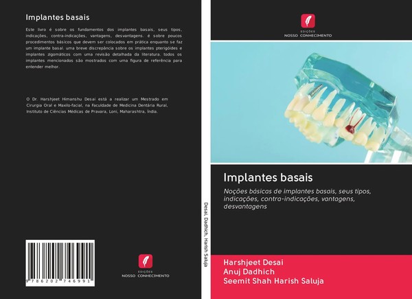 Harshjeet Desai (U. A.) | Implantes Basais | Taschenbuch | Portugiesisch (2020)-image