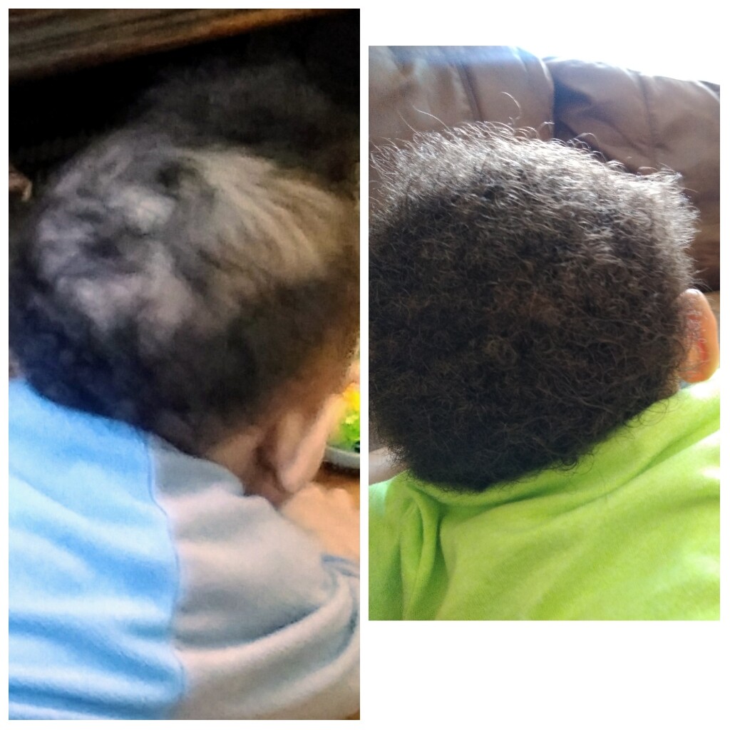 Organic Hair Growth Oil Serum treatment  1 oz. Alopecia,Bald Spots,Thinning hair