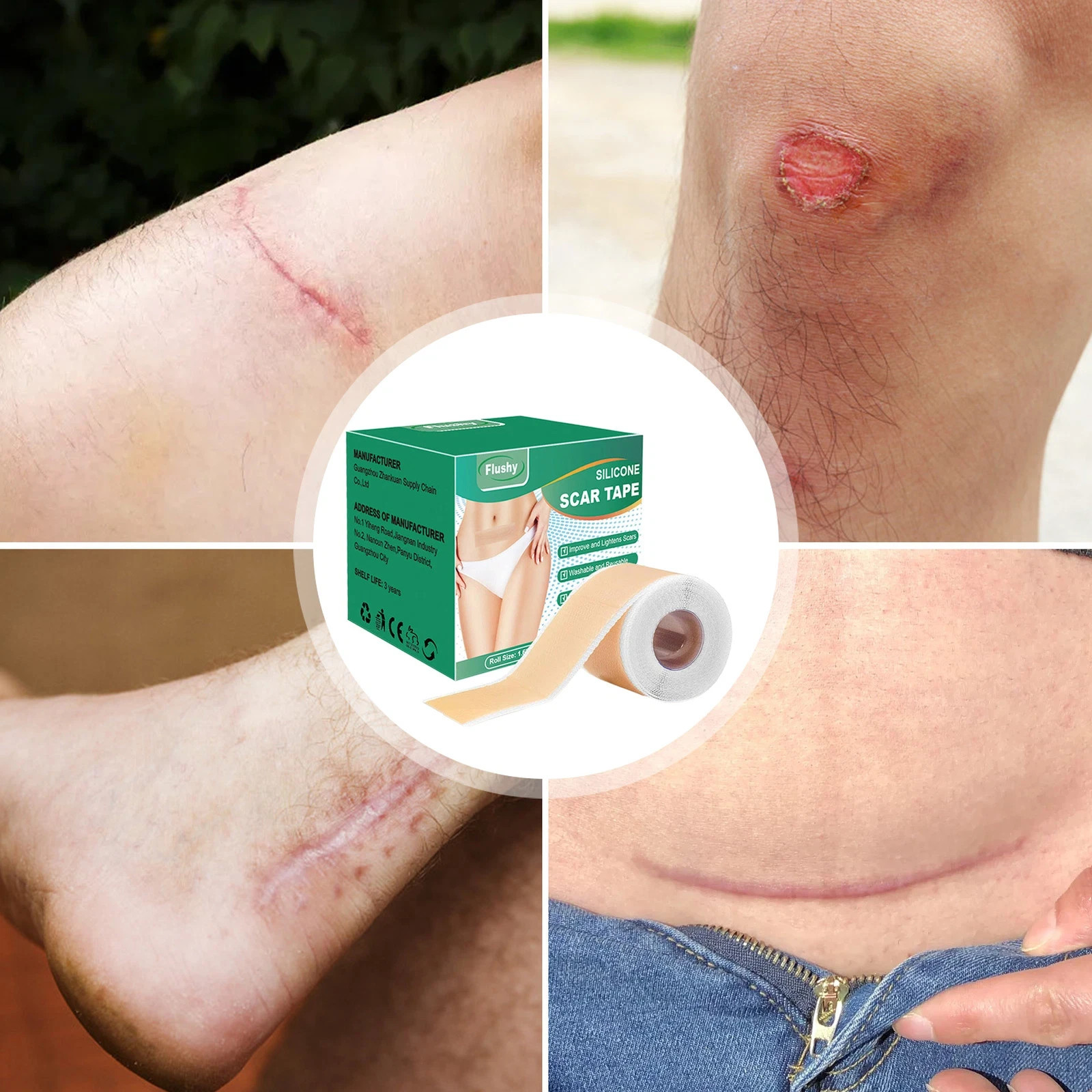 Silicone Scar Tape Scar Removal Sheets Surgical Skin Care (1.6'' x59'' Roll)