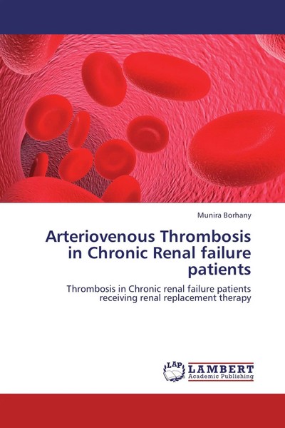 Munira Borhany | Arteriovenous Thrombosis In Chronic Renal Failure Patients-image