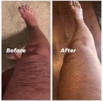 Nu Skin NuSkin ageLOC Dermatic Effects Body Contour Treatment