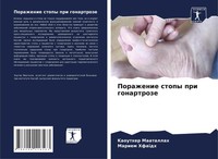 Kaouther Maatallah (U. A.) | Porazhenie Stopy Pri Gonartroze | Taschenbuch