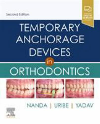 Temporary Anchorage Devices in Orthodontics by Flavio Andres Uribe (2020, ...