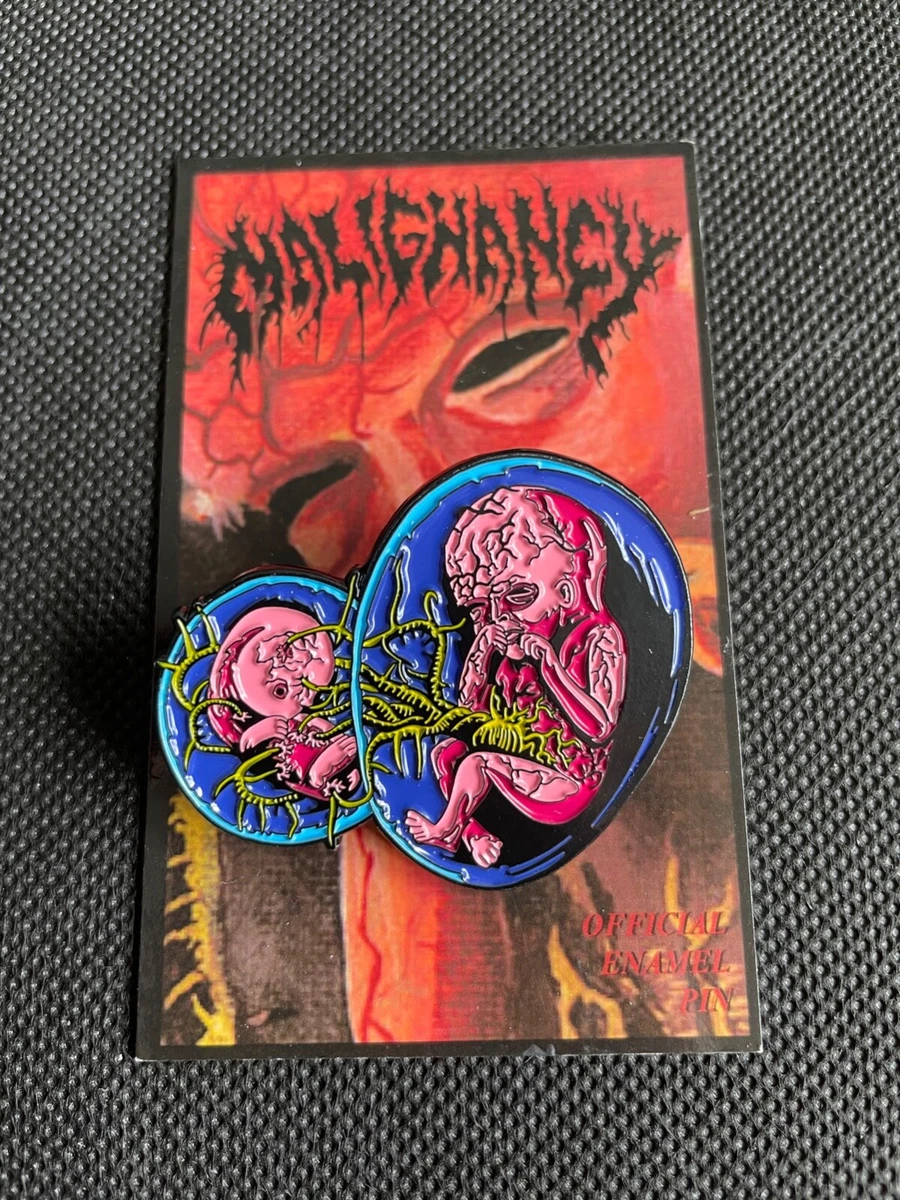 Malignancy intrauterine cannibalism official pin