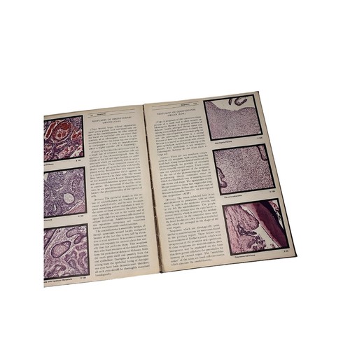 Vintage 1956 Color Atlas Of Oral Pathology Hardcover Book - Dentist - Foto 18 di 18