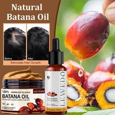 Batana Oil Serum Spray for Hair Growth Healthier Thicker Fuller Anti Hair Loss