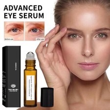  Rollerball Castor Extract  Frankincense Castor Essence and Frankincense Eye
