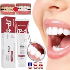 Sp-6 Probiotic Brightening Toothpaste Teeth Whitening Fresh Breath Removal 120g