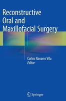 Reconstructive Oral And Maxillofacial Surgery Carlos Navarro Vila
