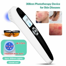 308nm Excimer Blue Light Therapy Device 6 Diodes 20mW/cm  Handheld UVB Lamp
