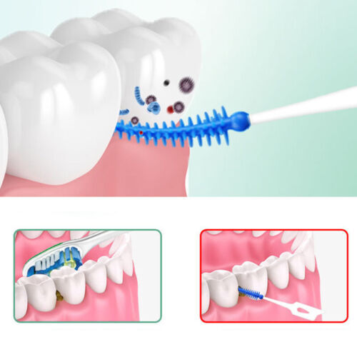 400 Stück/10 Boxen Zahnpflege Zahnseide, Zahnstocher, Interdentalsticks, saubere Bürste - Bild 4 von 17
