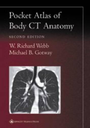 W. Richard Webb Michael B. Gotway Pocket Atlas of Body CT Anatomy (Paperback)