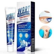 Genital Wart Removal Treatment Cream. 20g