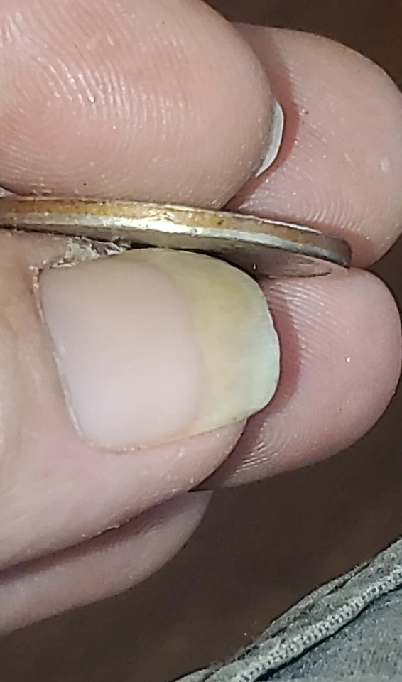 2000 D off metal overstrike double denomination sacagawea error - Image 4 of 4