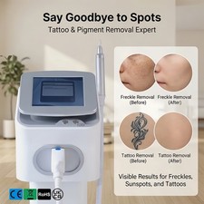 New ND YAG Picosecond Laser,Tattoo Pigment Removal, 5 Heads Picolaser Machine