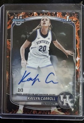 Washington Huskies Basketball Super Autograph Set 4: /3 & /5 of UW Best