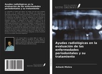 Ashank Mishra | Ayudas RadiolóGicas En La EvaluacióN De Las Enfermedades...
