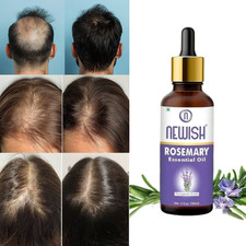Rosemary Essential Hair Oil control hair fall and repair damage hair 30 ml