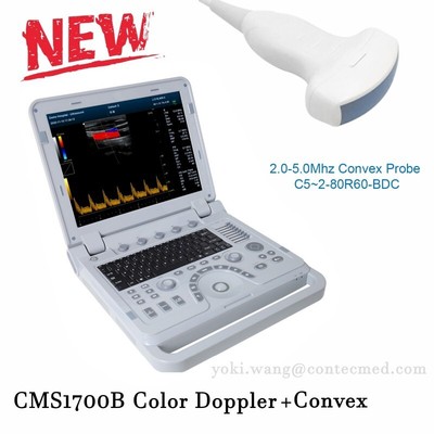 CMS1700B Color Doppler OB/GYN Ultrasonic Diagnostic System CF PW Abdonimal VET