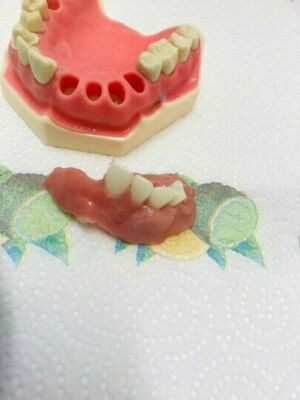 DIY Zahnersatz Set Sofort Teilprothese, Vollprothese oben oder unten OHNE SCHIMMEL