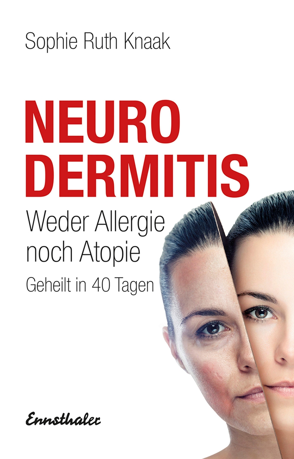 Thumbnail - Neurodermitis Sophie Ruth Knaak 9783850685184