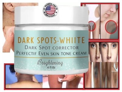 Cream white dark spots 4onz hands face supports skintone beauty skin even tone