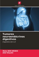 Wala Ben Kridis (U. A.) | Tumores NeuroendóCrinos Digestivos | Taschenbuch