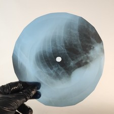 DAVID BOWIE SONG FOR BOB DYLAN X-Ray USSR Record Roentgen Bone Ribs Music Vinyl